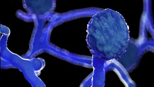 ابنتها تروي تفاصيل صادمة.. حكاية أول مصابة بالفطر الأسود في مصر | فيديو