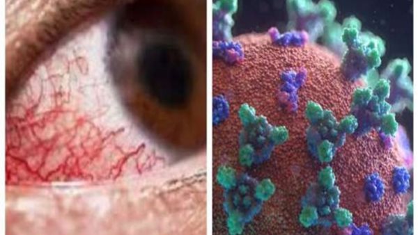 لا تتجاهلها.. 6 أعراض تكشف إصابتك بالفطر الأسود | فيديو 