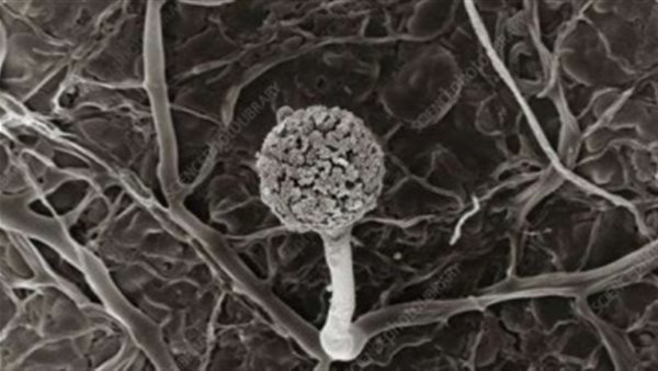 الفطر الأسود.. الصحة تعلن أسباب الإصابة وتقدم نصائح للحماية