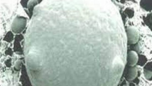 هؤلاء الأكثر عرضة للإصابة..لماذا الفطر الأبيض أخطر من الأسود ؟ 