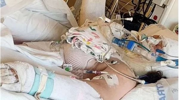 بسبب حيلة بـ التيك توك.. فتاة تشعل النار في نفسها وتصاب بحروق خطيرة