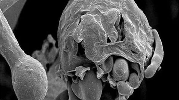 مفاجأة جديدة .. بشرى سارة من الصحة العالمية عن الفطر الأسود