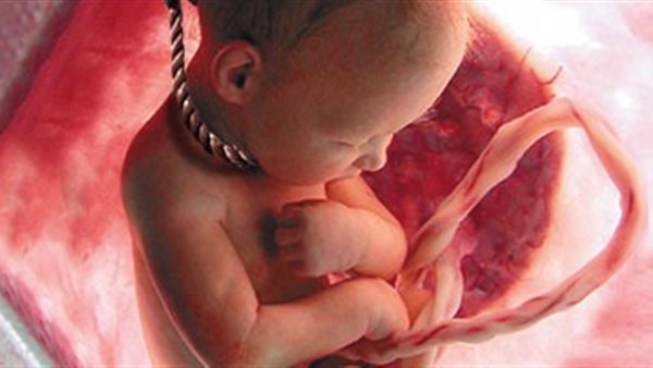 تفاصيل يستحيل تصورها.. سورية تجهض نفسها وتستخدم جثة الجنين في نقل المخدرات