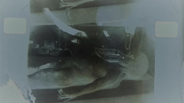 عينان كبيرتان وجمجمة.. فيديو نادر يظهر لحظة تشريح جثة كائن فضائي | شاهد