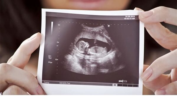 حكم الشرع في تحديد نوع الجنين؟.. دار الإفتاء تجيب