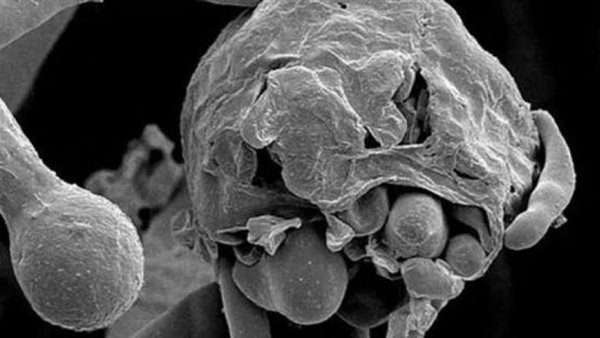 احذر هذه الأشياء..13 نصيحة لتجنب الإصابة بالفطر الأسود