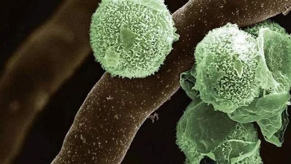  بعد الأسود والأبيض والأصفر.. أسباب واعراض الفطر الأخضر 