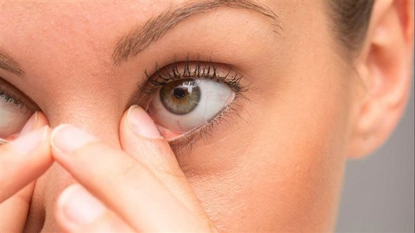 انتبه.. علامة في العين تدل على إصابتك بـ مرض عصبي