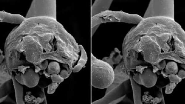 الصحة العالمية تحسم الجدل..ماذا يفعل الفطر الأسود بالجسم وعلاقته بكوفيد 19؟
