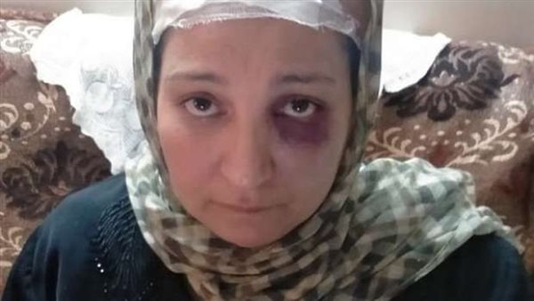 جابها من شعرها.. أول فيديو للحظة اعتداء الجزار على سيدة السلام | شاهد