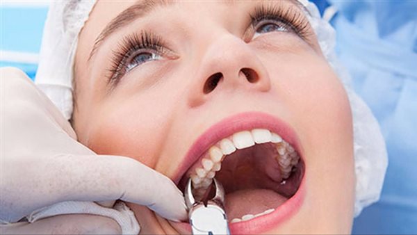 مش هتصدق.. سيدة تقتلع 13 سنا من مريضة بعد تخديرها