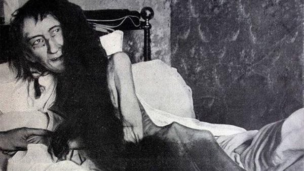 رائحة كريهة كشفت الأسباب.. سر حبس أم لابنتها 25 عاما في غرفة نومها | شاهد 