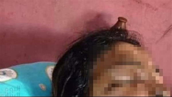 شوه جسمها بمية نار.. سائق ينتقم من طليقته: 8 سنين مبتخلفش وخلعتني