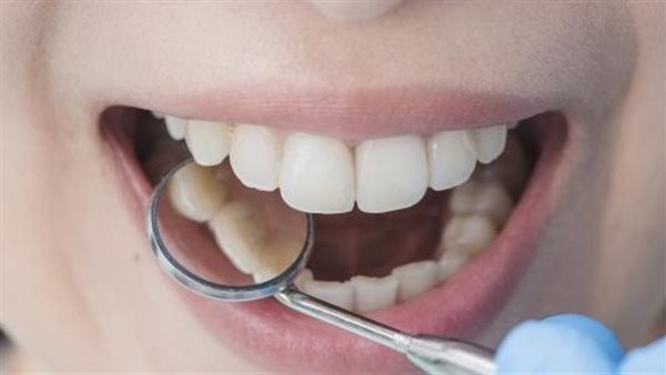 خلى بالك.. معاناة الأسنان من هذا الأمر دليل على إصابتك بـ السرطان