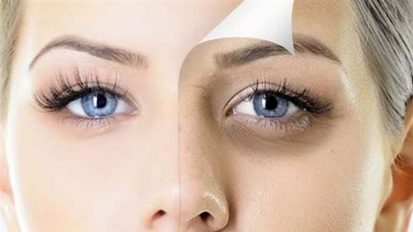 بمواد طبيعية ورخيصة..عالجي الهالات السوداء من داخل «مطبخك»