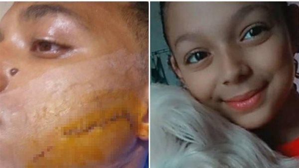 سمع صراخها بين السيارات وكاد يفقد حياته.... بطولة «يوسف» تنقذ شقيقته من الاغتصاب