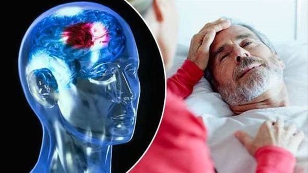 احذر.. علامات على وجه الإنسان تنذر بحدوث وشيك للسكتة الدماغية