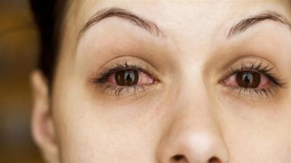  تعرف عليها.. أسباب دموع العين لا إراديا