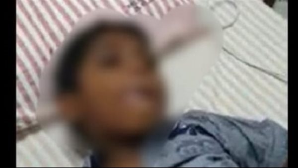 عضه كلب مسعور ولم يحصل على المصل.. قصة حزينة لطفل «بيهوهو»