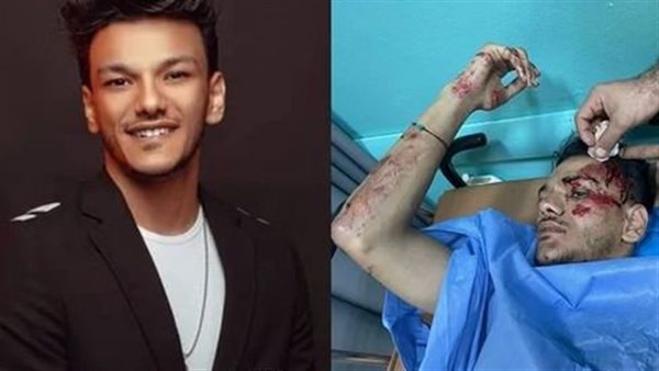 بعد حادث مروع.. حقيقة وفاة مطرب المهرجانات حودة بندق