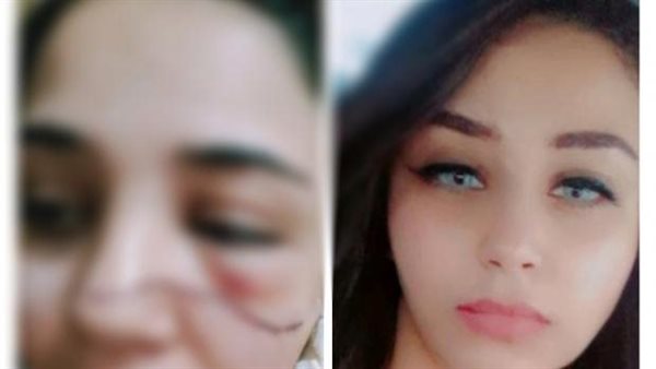 شكلي راح واتجوزته برده..منة رفضت عريس شقيقتها فشوه وجهها