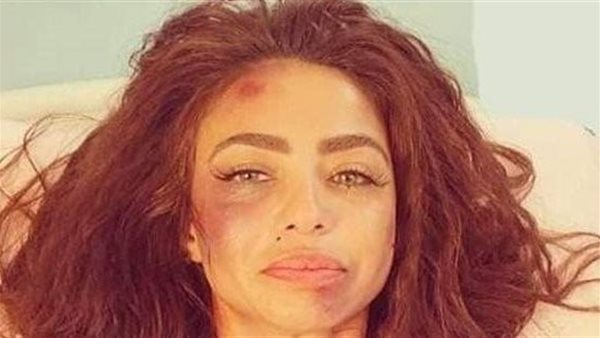 حالتها سيئة.. تفاصيل الاعتداء على دوللي شاهين | شاهد