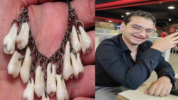 التفاصيل الكاملة..حقيقة خلع شاب أسنانه كاملة من أجل إهدائها لحبيبته على هيئة عقد 