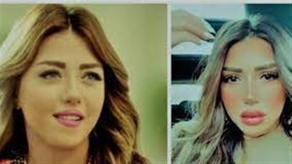  آخرهن سارة سلامة..نجمات صدمن الجمهور بإطلالاتهن بعد عمليات التجميل | شاهد