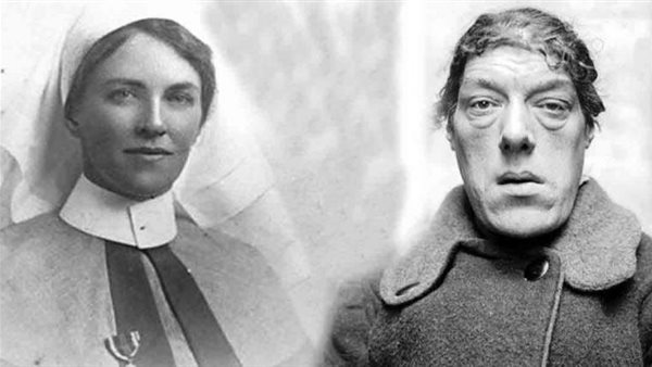 قصة أقبح امرأة في العالم.. سر تحول «ماري» من امرأة فاتنة الجمال لـ «كائن بشع»