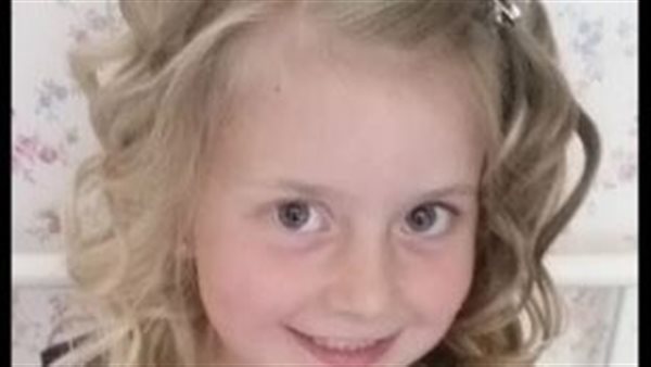 بتغير اللون حسب ملابسها.. حالة وراثية تتسبب في معجزة بشعر ورموش طفلة | شاهد 