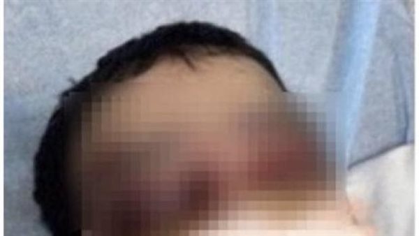 قطع لسان وفقأ عين.. قصة مأساوية لـ معنفة جدة مع زوجها