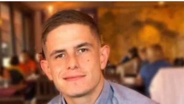 النيران التهمت جسده كله..معجزة تعيد شابًا للحياة بعد 27 يوما في غيبوبة