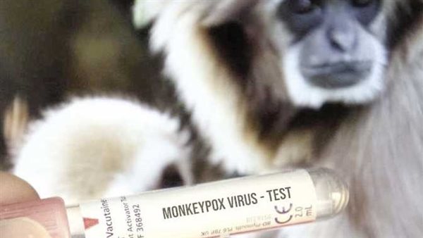 كواشف تشخيصية.. بيان جديد من الصحة بشأن جدري القرود