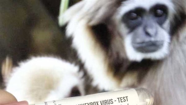 27 دولة.. الصحة العالمية تعلن تطورات جديدة بشأن جدري القرود