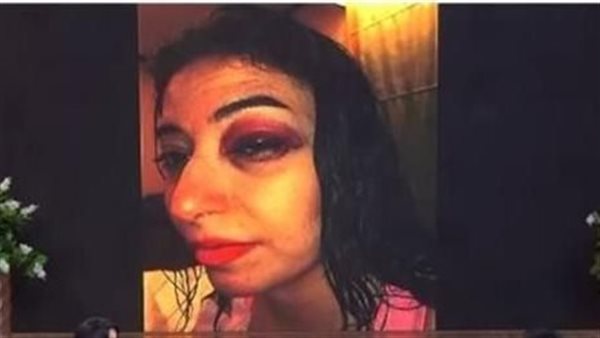 عيني كانت هتروح.. ماذا حدث لـ غادة رجب بعد حفل زفافها ؟