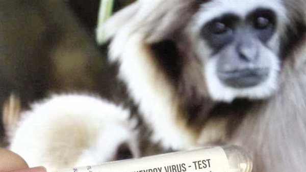 قلق عميق.. الصحة العالمية تصدر بيانا مهما بشأن تفشي جدري القرود