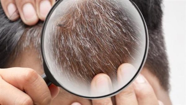 تحذير من الصبغة..أطعمة غير متوقعة تمنع نمو الشعر الأبيض