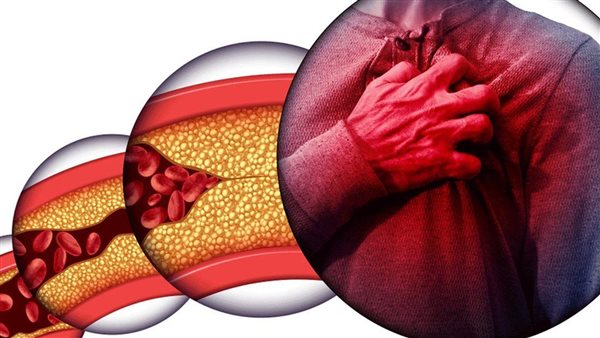 تعرف عليها..3 أطعمة تخفض مستويات الكوليسترول في الجسم بشكل سريع