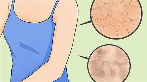 للرجال والنساء.. أماكن بالجسم يجب تنظيفها كل يوم حتى لو مش هتستحمى