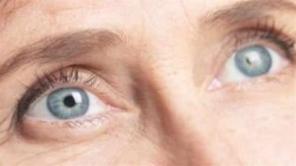 طبيب يكشف.. أسباب الإصابة بالمياه الزرقاء في العين وطرق العلاج 