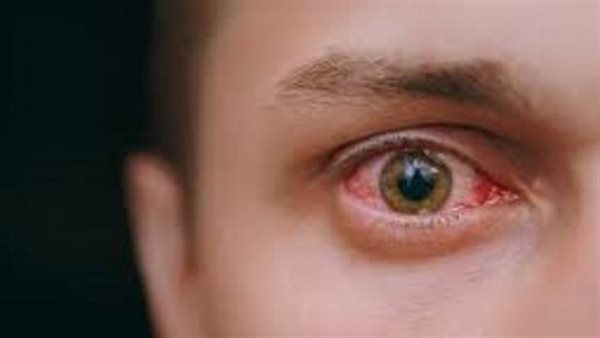 تظهر على الجلد والعين والقلب..13 علامة تدل على الإصابة بأمراض خطيرة