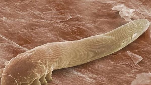 تشبه الدودة.. حشرة تعيش على الوجه حتى الوفاة: تسبب جفافه في هذه الحالة