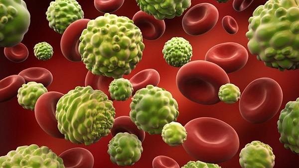 احذر هذا المرض.. القاتل الأكثر انتشارا في العالم