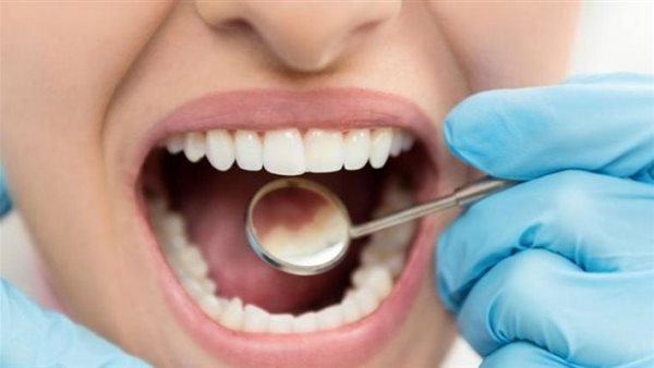  منها حمض النشويات.. طبيبة تحذّر من عادات يومية تدمّر الأسنان