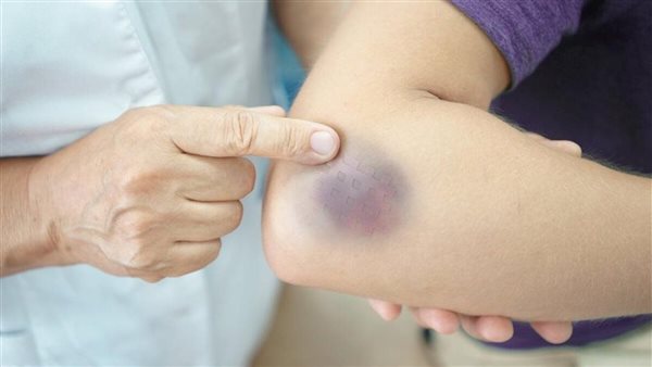 احذر منها..8 علامات إذا رأيت إحداها على جسمك فاذهب للطبيب فورا