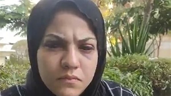 ضربني بالكورباج ومضاني على تنازلات.. سيدة تروي تفاصيل مأساوية عن اعتداء زوجها عليها