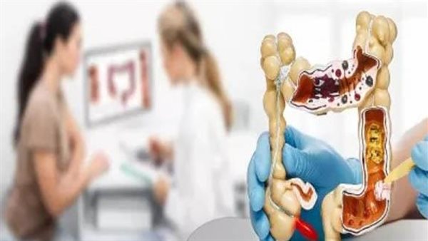 لقولون أكثر صحة.. احرص على تناول هذه الأطعمة الـ 6