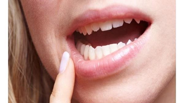 انتبه.. 4 علامات تشير إلى سرطان الفم لا يجب تجاهلها 