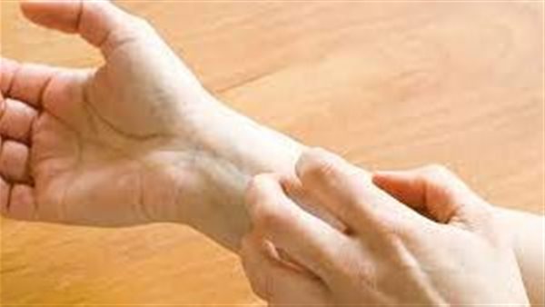 منها مشكلات الحكة..4 علامات مفاجئة قد تعني الإصابة بمرض السكر