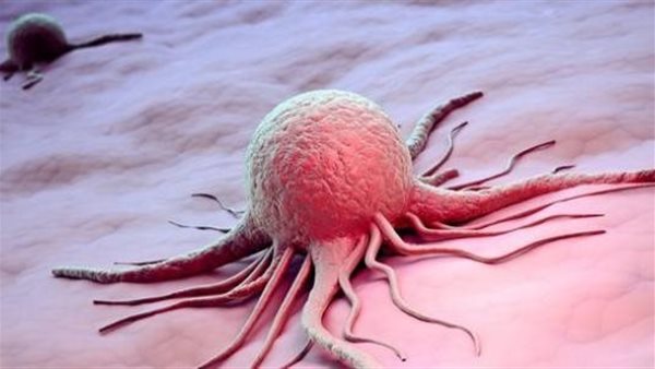  انتبه.. 5 علامات تحذيرية لتجنب أكثر السرطانات شيوعًا